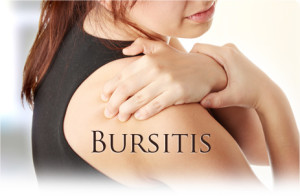 Bursitis Cure